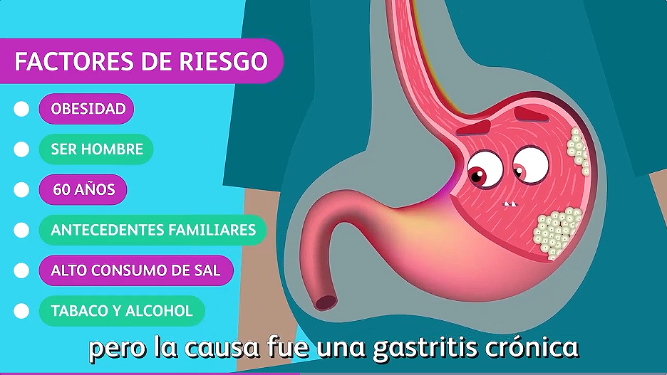 Video: En Serio Es Gastritis